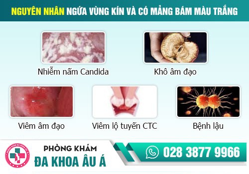 Như thế nào là mụn ngứa âm đạo?