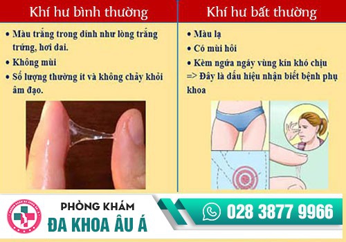Ra khí hư nhiều - dấu hiệu của nhiễm trùng?