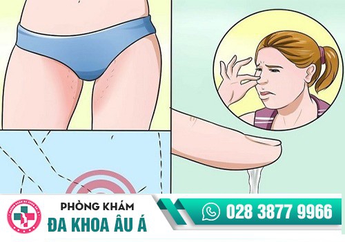 Dịch tiết âm đạo